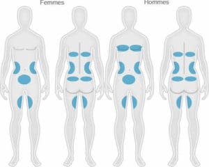 Coolsculpting_zones_femmes