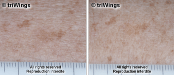 LED-TACHES-ARTHESTIC