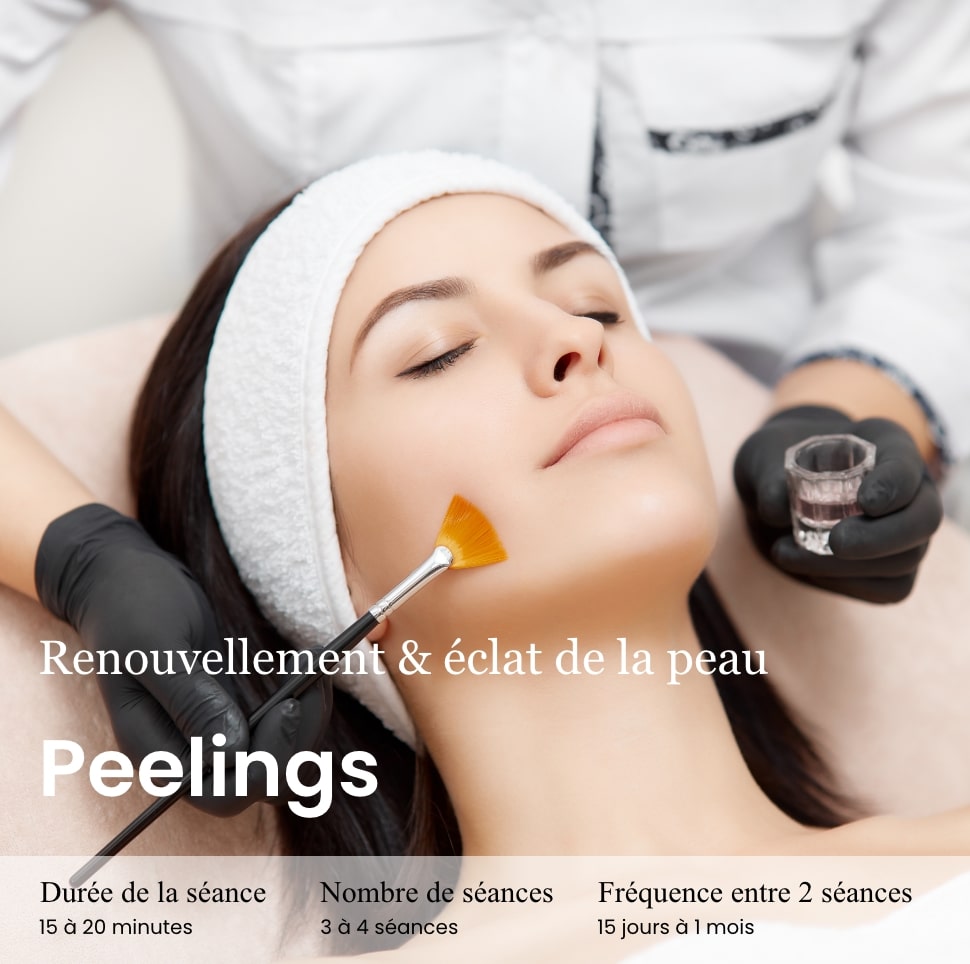 peeling chimiques, peeling nouvelle peau, peeling peaux noires, peeling contre les taches