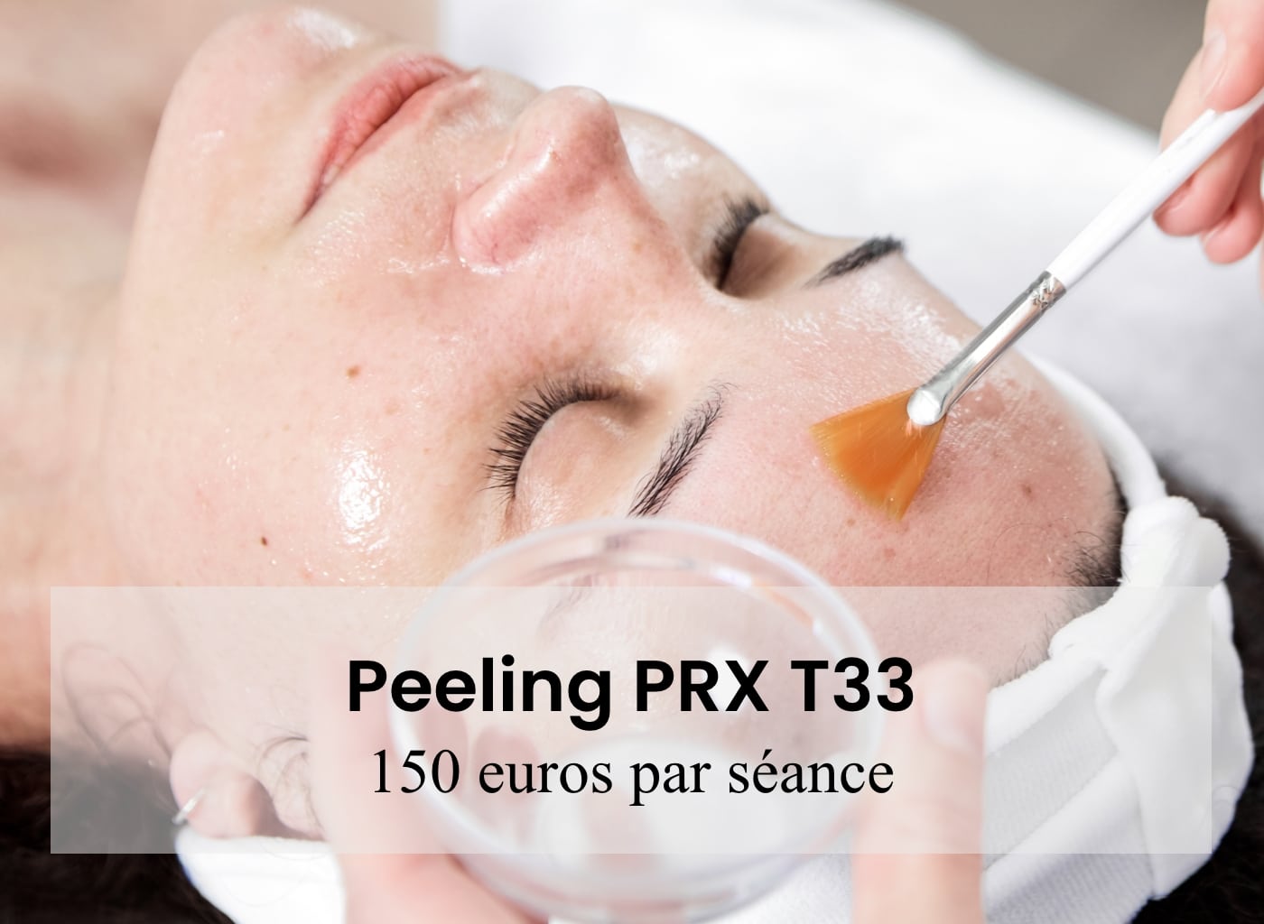 prix peeling paris, prix peeling arthestic paris, prix moyen peeling paris