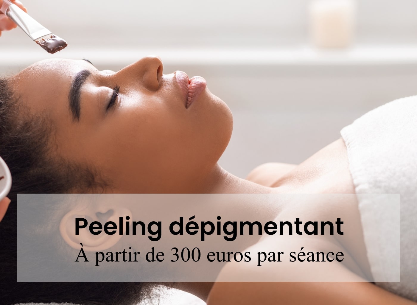 prix peeling paris, prix peeling arthestic paris, prix moyen peeling paris