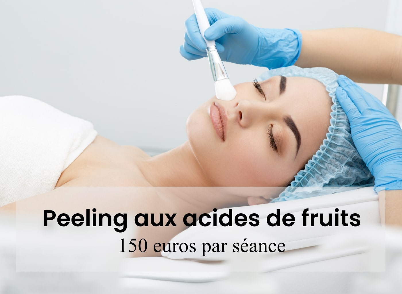 prix peeling paris, prix peeling arthestic paris, prix moyen peeling paris