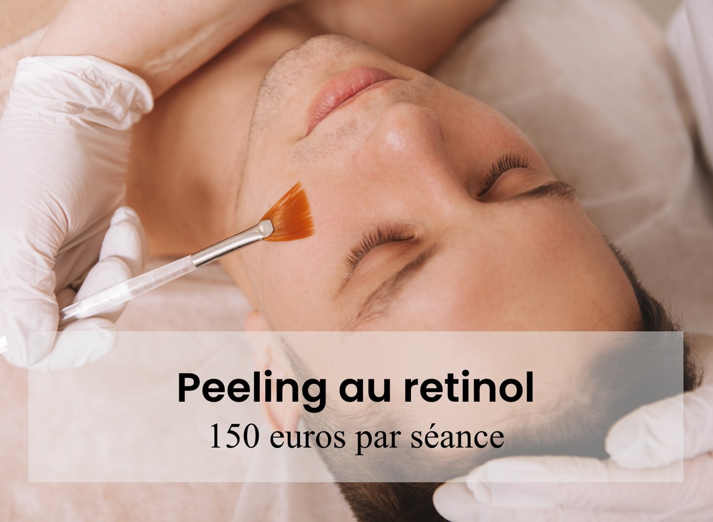 prix peeling paris, prix peeling arthestic paris, prix moyen peeling paris