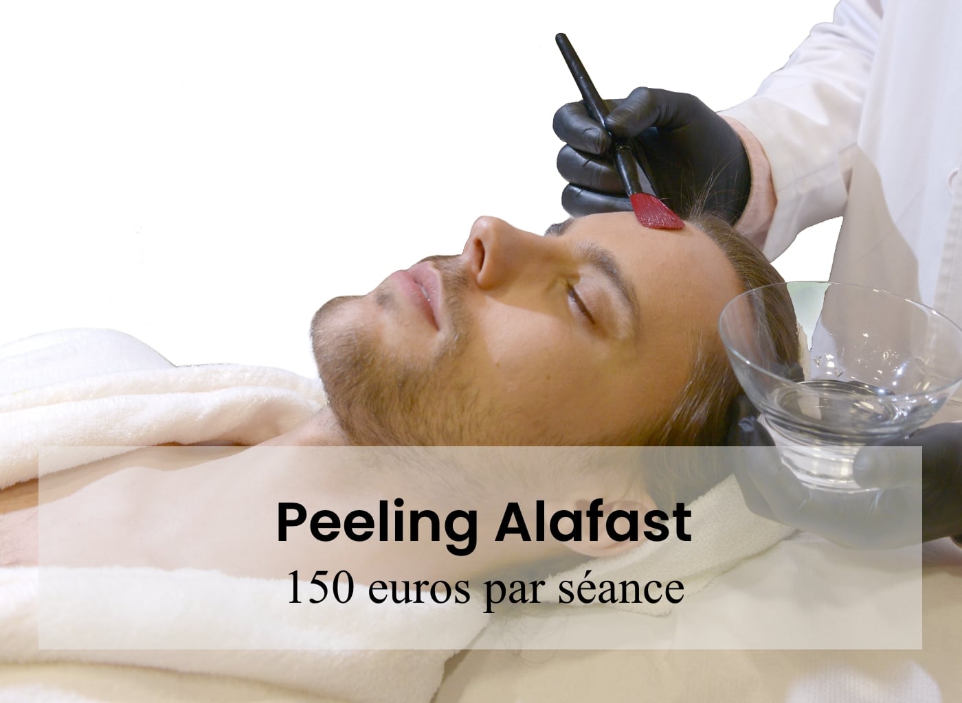 prix peeling paris, prix peeling arthestic paris, prix moyen peeling paris