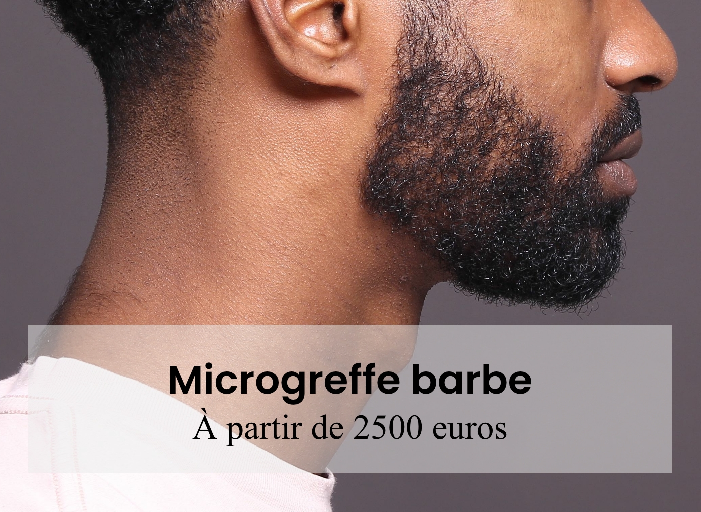 Greffe de barbe à Paris - ARTHESTIC