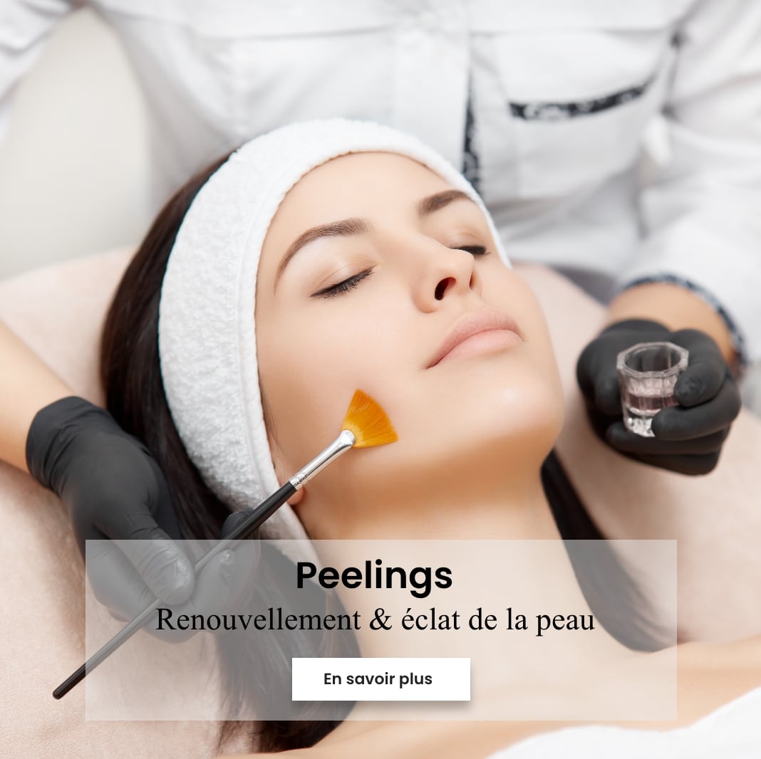 peeling chimiques, peeling nouvelle peau, peeling peaux noires, peeling contre les taches