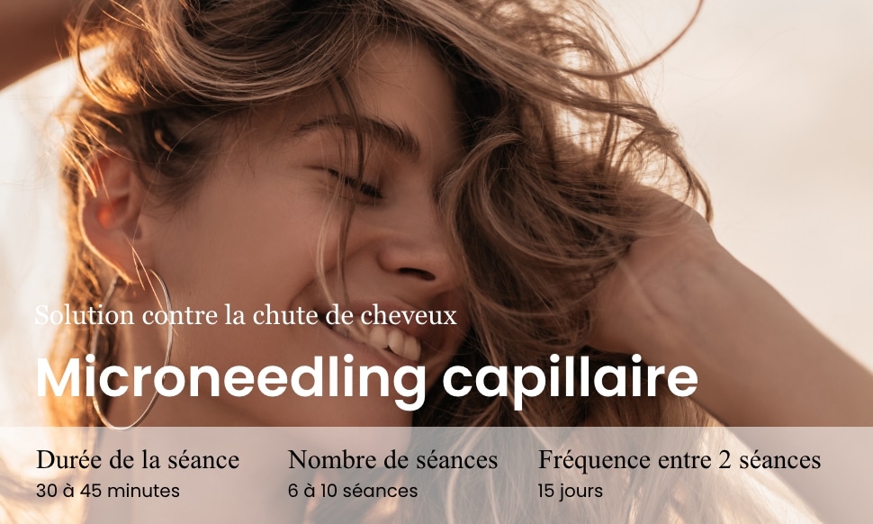 microneedling capillaire arthestic Paris