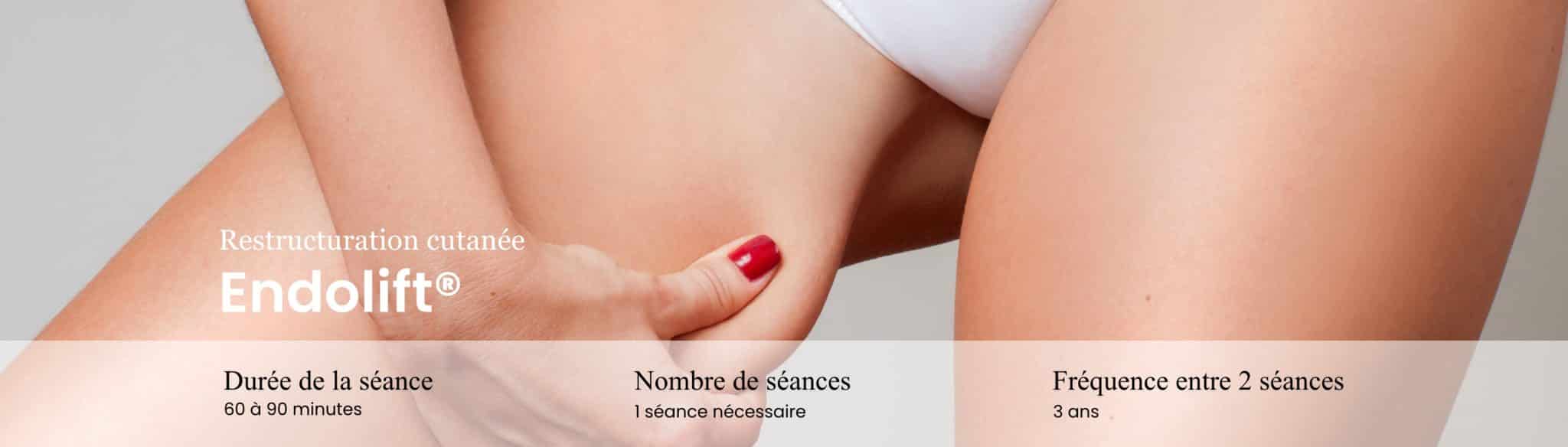 ENDOLIFT® ARTHESTIC PARIS