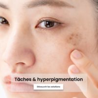 TACHES ET HYPERPIGMENTATION ARTHESTIC SOLUTION  MEDECINE ESTHETIQUE PARIS