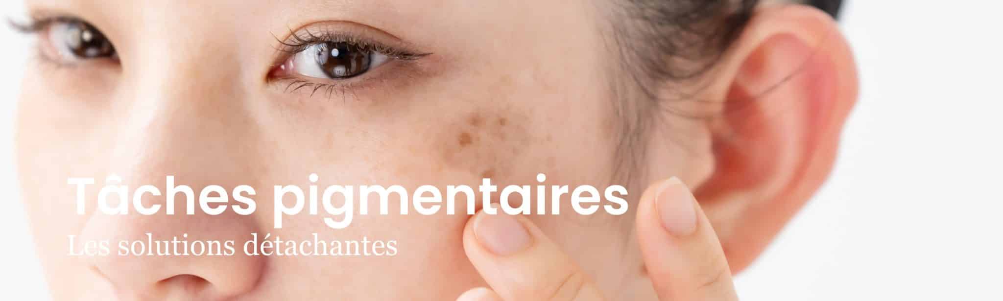 TÂCHES PIGMENTAIRES SOLUTION ARTHESTIC PARIS MÉDECINE ESTHETIQUE